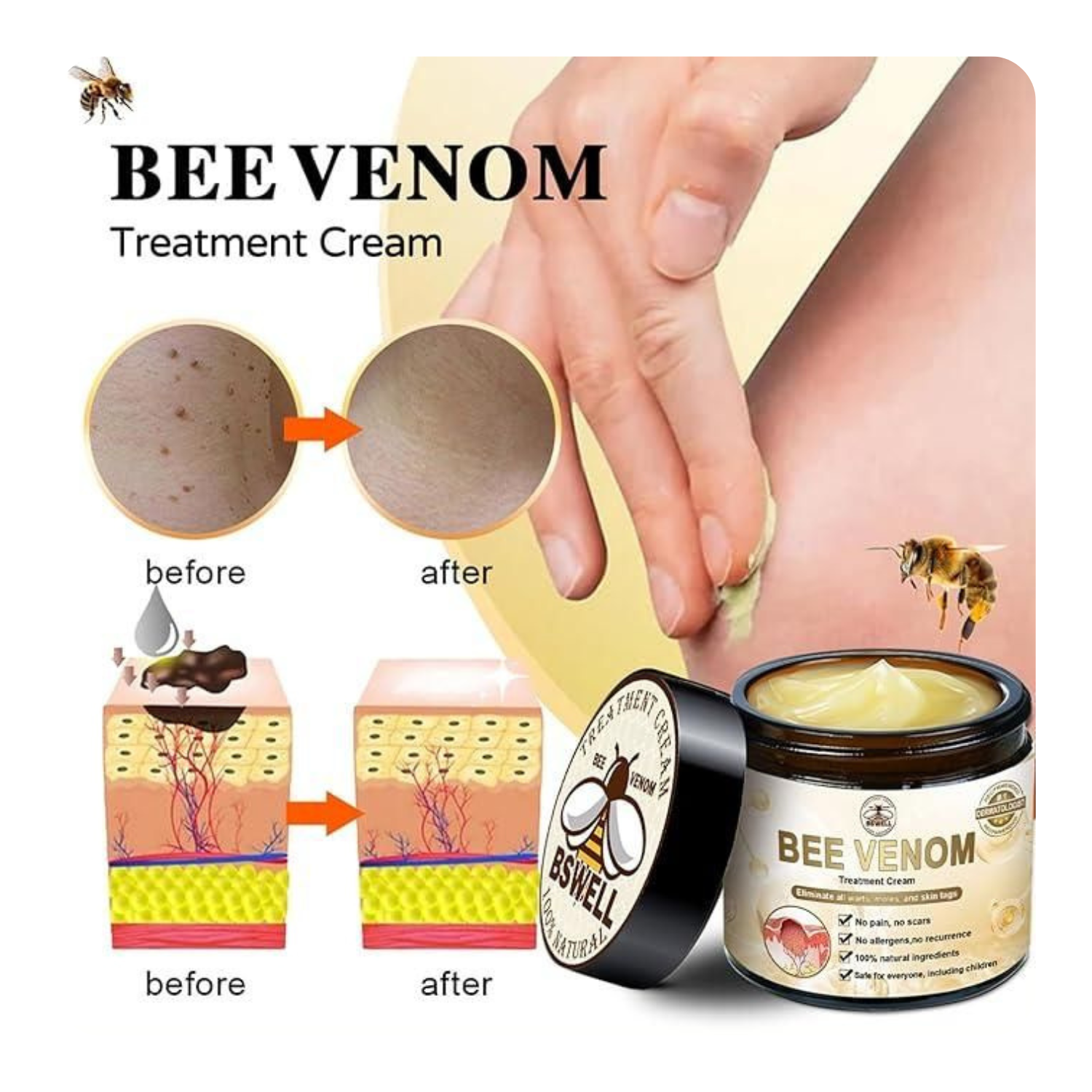 Bee Venom Skin Treatment Cream 100g (Pack of 2)